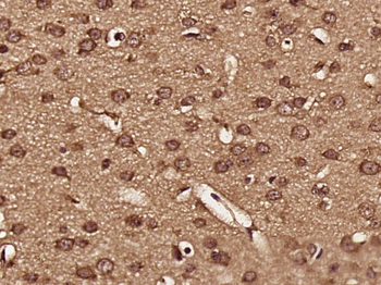 ENDOD1 Rabbit Polyclonal Antibody