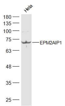 EPM2AIP1 Rabbit Polyclonal Antibody