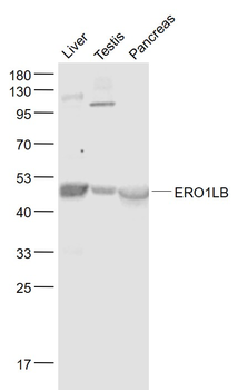 ERO1LB Rabbit Polyclonal Antibody