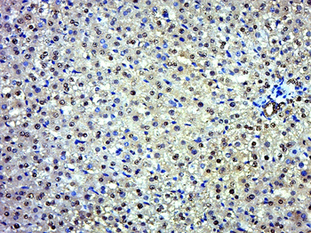 EXD2 Rabbit Polyclonal Antibody