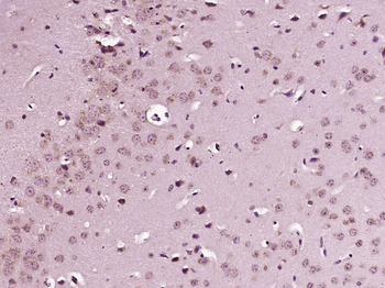 EXDL1 Rabbit Polyclonal Antibody