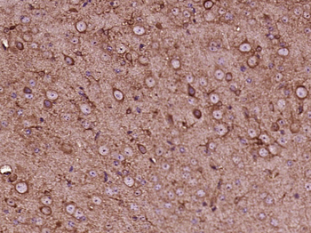 EXOC8 Rabbit Polyclonal Antibody