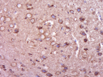 EXOSC6 Rabbit Polyclonal Antibody