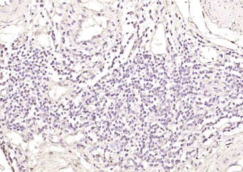 Exportin T Rabbit Polyclonal Antibody