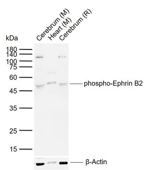 Phospho-Ephrin B2 (Tyr311/316) Rabbit Polyclonal Antibody