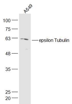Epsilon Tubulin Rabbit Polyclonal Antibody