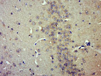 FAM171A2 Rabbit Polyclonal Antibody