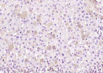 FAM198B Rabbit Polyclonal Antibody
