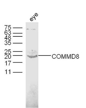 COMMD8 Rabbit Polyclonal Antibody