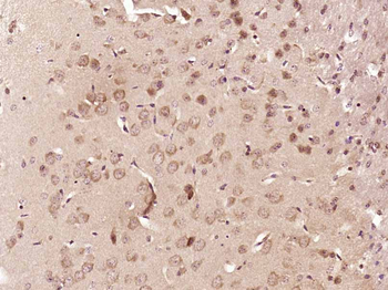 FAM83E Rabbit Polyclonal Antibody