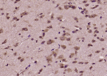 FBXO10 Rabbit Polyclonal Antibody