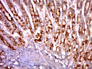 FCHO2 Rabbit Polyclonal Antibody