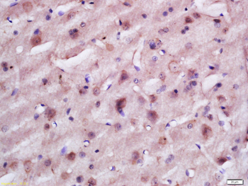FLJ36733 Rabbit Polyclonal Antibody