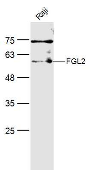 FGL2 Rabbit Polyclonal Antibody