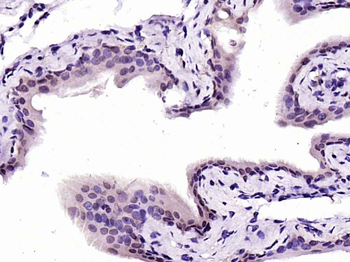 CNOT2 Rabbit Polyclonal Antibody