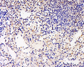 GAL3ST2 Rabbit Polyclonal Antibody