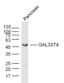 GAL3ST4 Rabbit Polyclonal Antibody