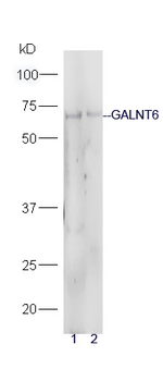 GALNT6 Rabbit Polyclonal Antibody
