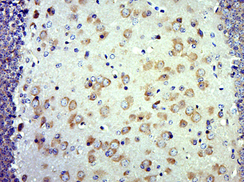 GALNT9 Rabbit Polyclonal Antibody