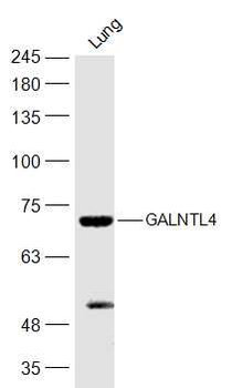 GALNTL4 Rabbit Polyclonal Antibody