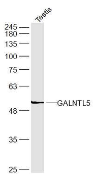 GALNTL5 Rabbit Polyclonal Antibody