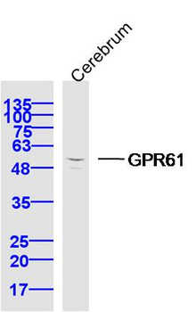 GPR61 Rabbit Polyclonal Antibody