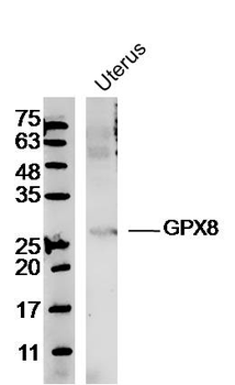 GPX8 Rabbit Polyclonal Antibody