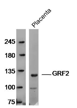 GRF2 Rabbit Polyclonal Antibody