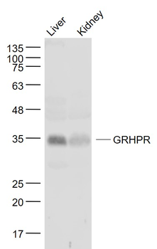 GRHPR Rabbit Polyclonal Antibody