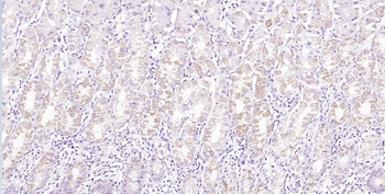 GSDMC Rabbit Polyclonal Antibody