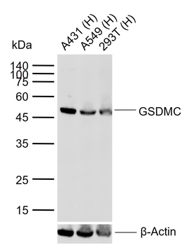 GSDMC Rabbit Polyclonal Antibody