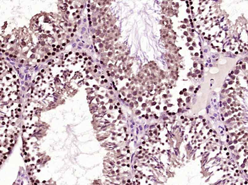 GTF3C4 Rabbit Polyclonal Antibody