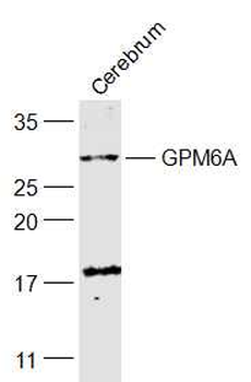 GPM6A Rabbit Polyclonal Antibody