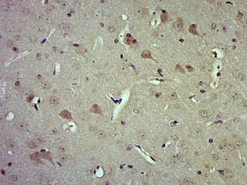 Phospho-Hck (Tyr411) Rabbit Polyclonal Antibody