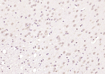 HnRNP A1 Rabbit Polyclonal Antibody