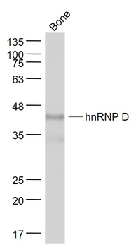 HnRNP D/AUF1 Rabbit Polyclonal Antibody