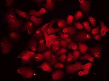 HnRNP A3 Rabbit Polyclonal Antibody