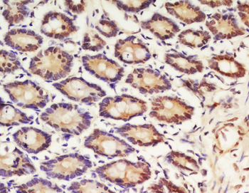 HnRNP A3 Rabbit Polyclonal Antibody
