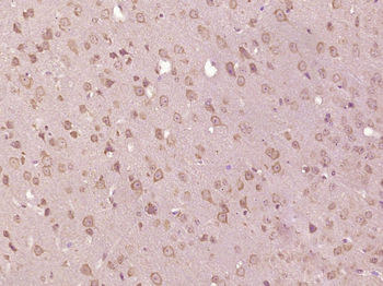HPCAL4 Rabbit Polyclonal Antibody