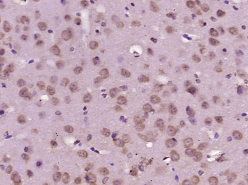 HPS5 Rabbit Polyclonal Antibody