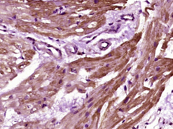 HRC Rabbit Polyclonal Antibody