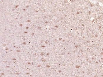 HIPK1 Rabbit Polyclonal Antibody