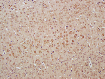 HMBOX1 Rabbit Polyclonal Antibody