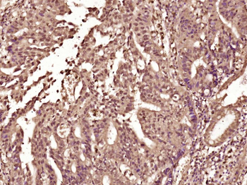 HMGXB3 Rabbit Polyclonal Antibody