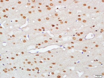 HnRNP M Rabbit Polyclonal Antibody