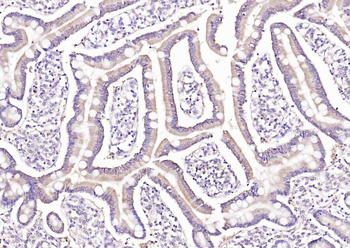 IREB2 Rabbit Polyclonal Antibody