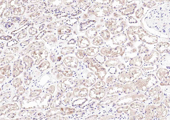 IREB2 Rabbit Polyclonal Antibody
