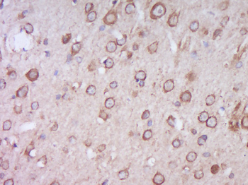ITPKB Rabbit Polyclonal Antibody