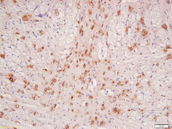 IL12B Rabbit Polyclonal Antibody