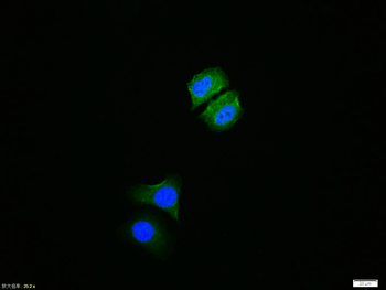 Phospho-IKB alpha (Ser36) Rabbit Polyclonal Antibody